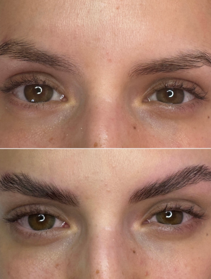 Lash And Browlifting